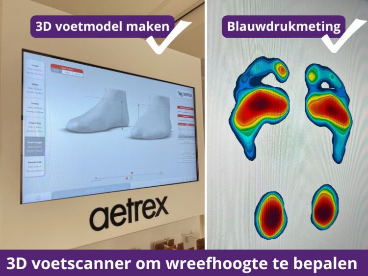 3D voetscanner om wreefhoogte te bepalen