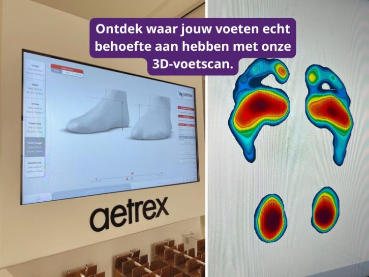 Laat je voeten analyseren met onze 3D voetscanner