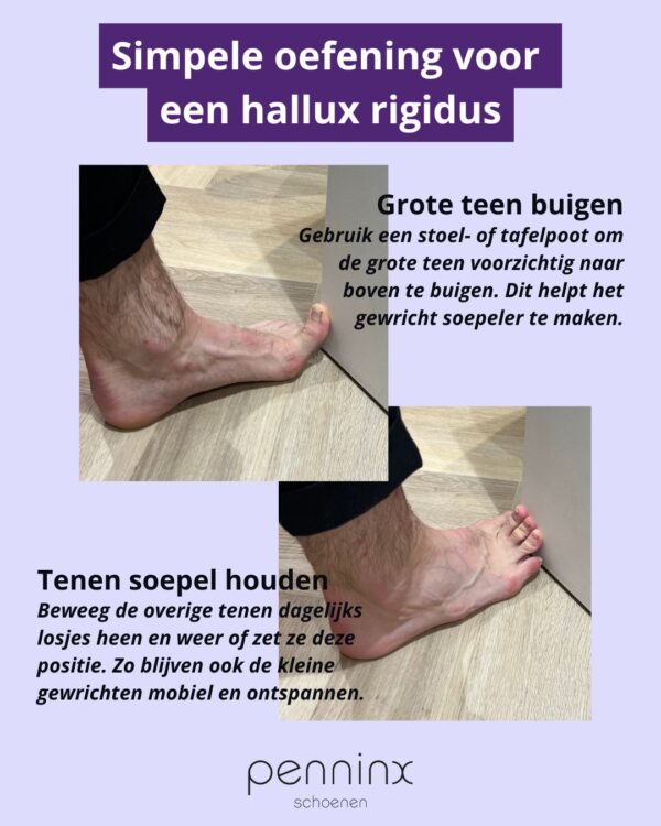 Oefening bij Hallux Rigidus