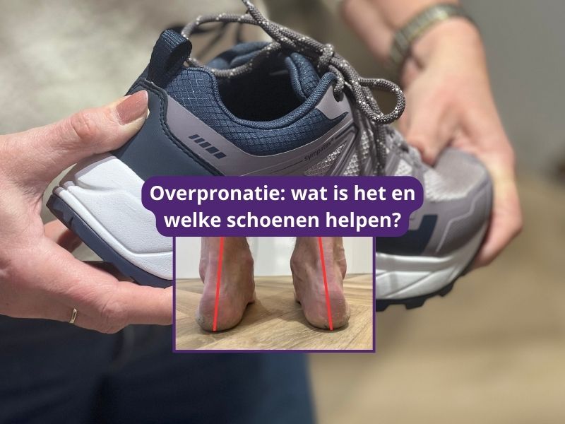 Overpronatie wat is het en welke schoenen helpen