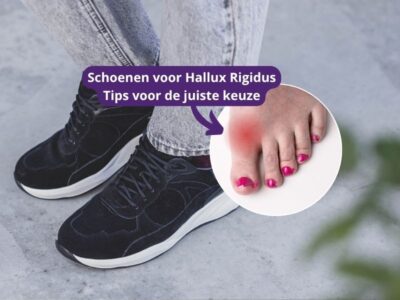 Schoenen voor hallux rigidus: dit zijn onze 6 beste keuzes