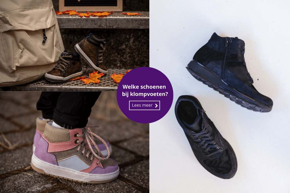 Schoenen voor klompvoeten: welke zijn geschikt?