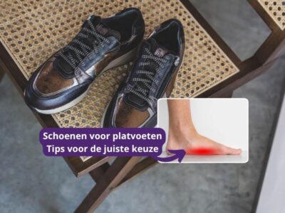 Hoe kies je de beste schoenen voor platvoeten?